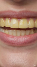 CREMA MORADA BLANQUEADOR DENTAL